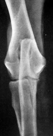 Рис. 13. Кранио-каудальная поверхность. Визуализируется мелкоячеистая структура спонгиозного костного вещества эпифизов.