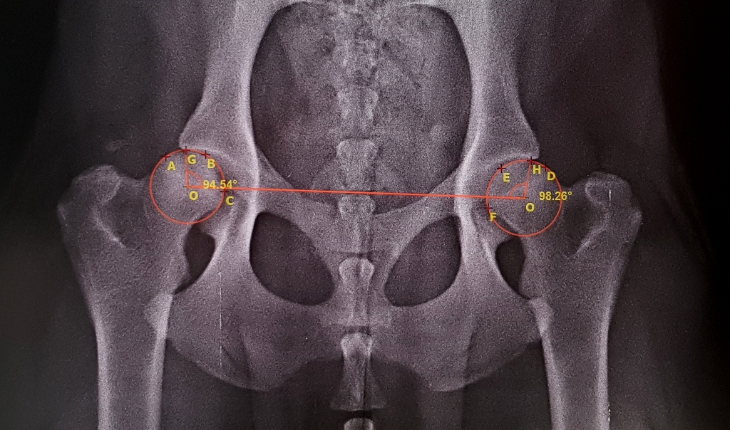 МРТ коленного сустава – показания