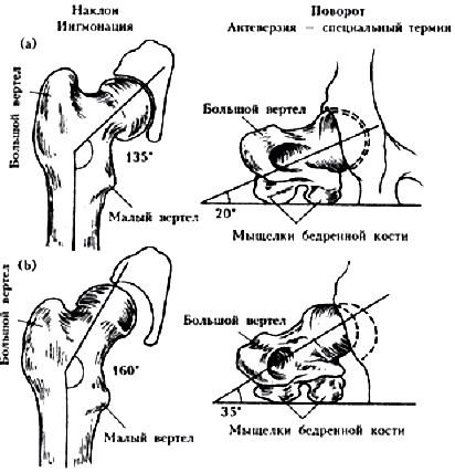 Определение и причины