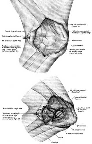 Рис. 10. Латеральный доступ к art. cubiti.